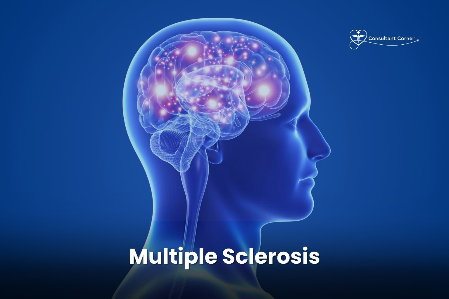 Multiple Sclerosis