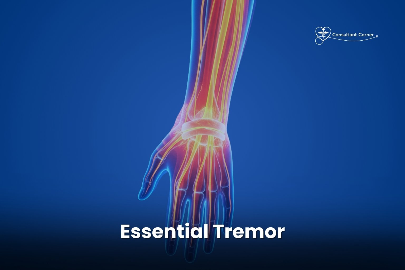 Essential Tremor
