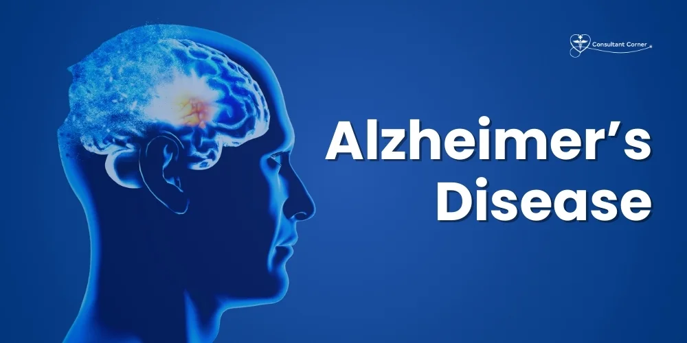 Alzheimer’s Disease
