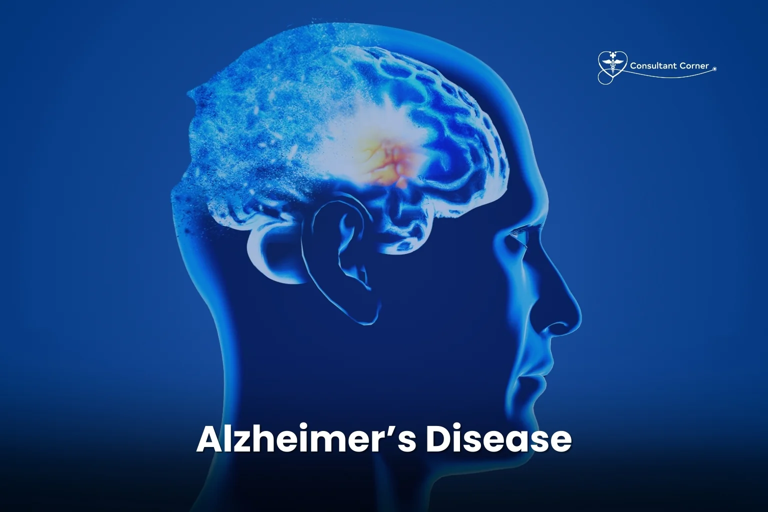 Alzheimer's Disease