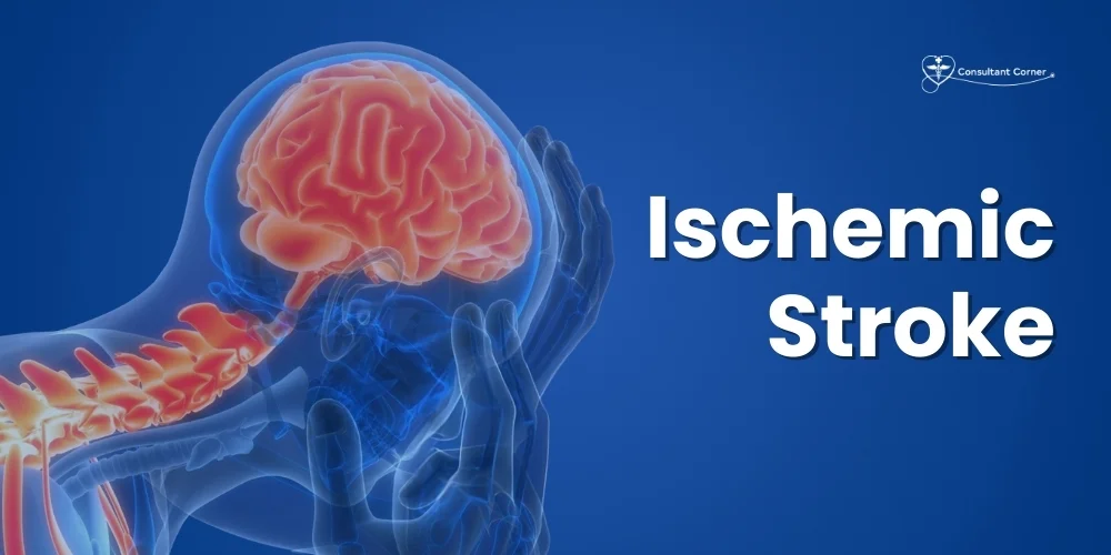 Ischemic Stroke